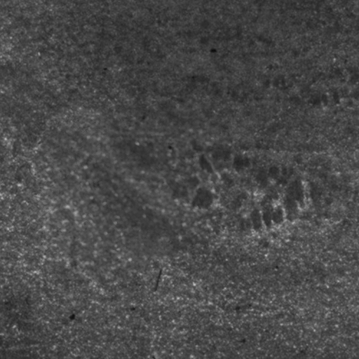 Solda faltante, cujos dados enviados pelo PLC indicam posição, enquanto o modelo de inteligência artificial através do sistema de visão constata a falta.